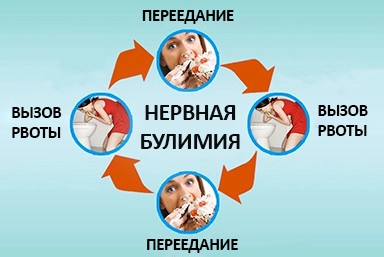 Лечение булимии в Рузаевке